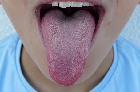 Se brosser la langue, bonne ou mauvaise habitude ?